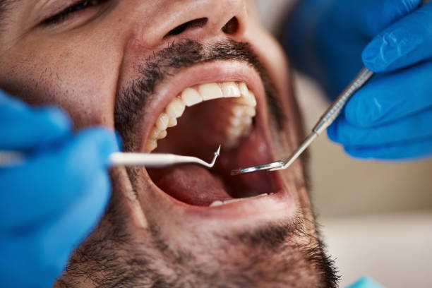 Laser Dentistry in Blythewood, SC